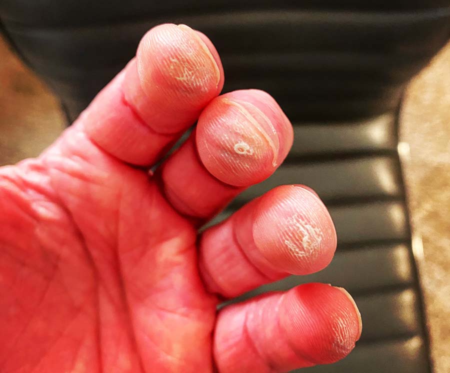 Yes rough hands will be part of the learning guitar process.